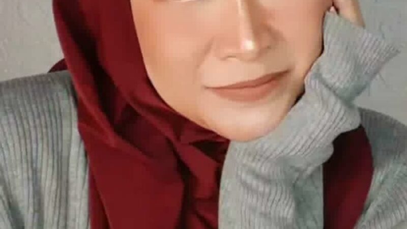 Edelyne Veronia Oehmke, Meski Diremehkan, Tetaplah Percaya Diri